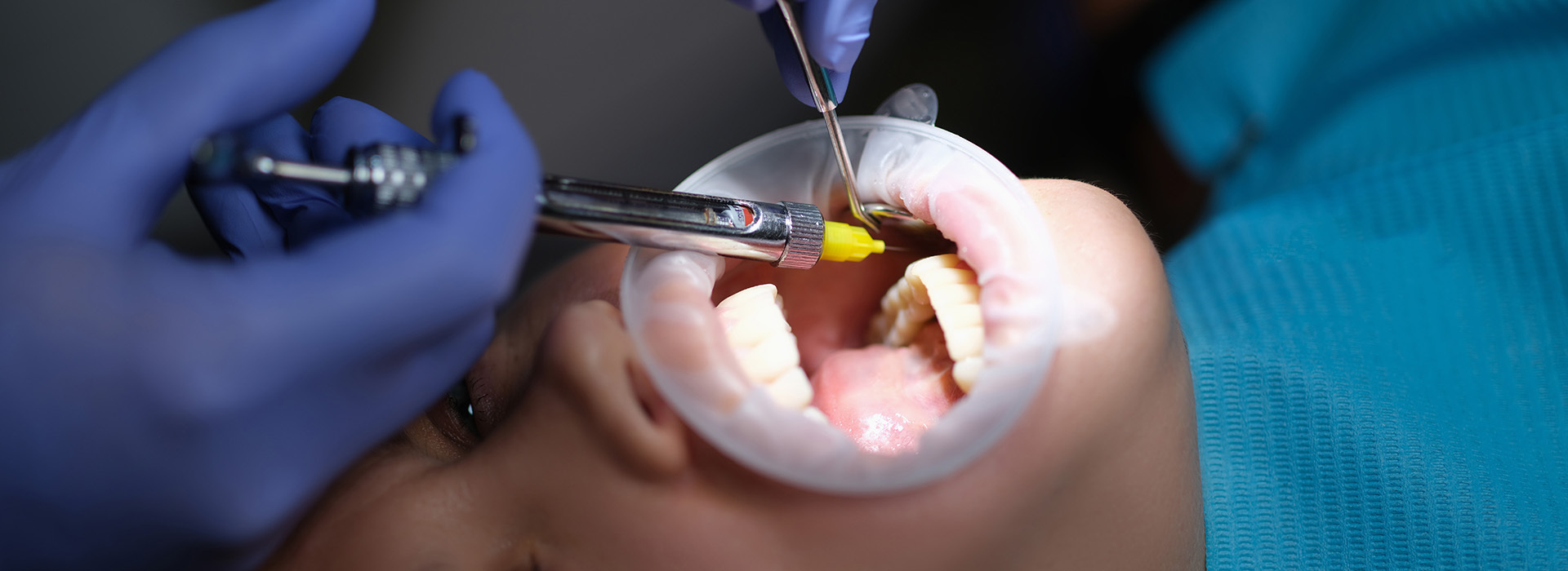 Dental Services in Dilsukhnagar